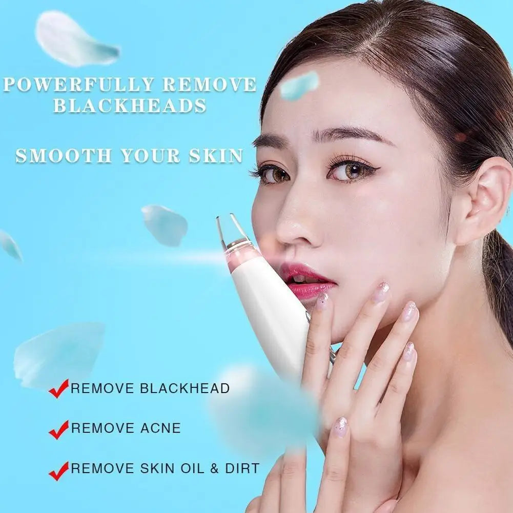 Quitador facial de puntos negros.