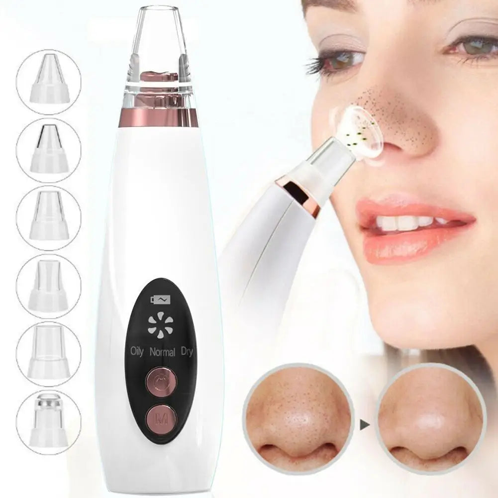 Quitador facial de puntos negros.